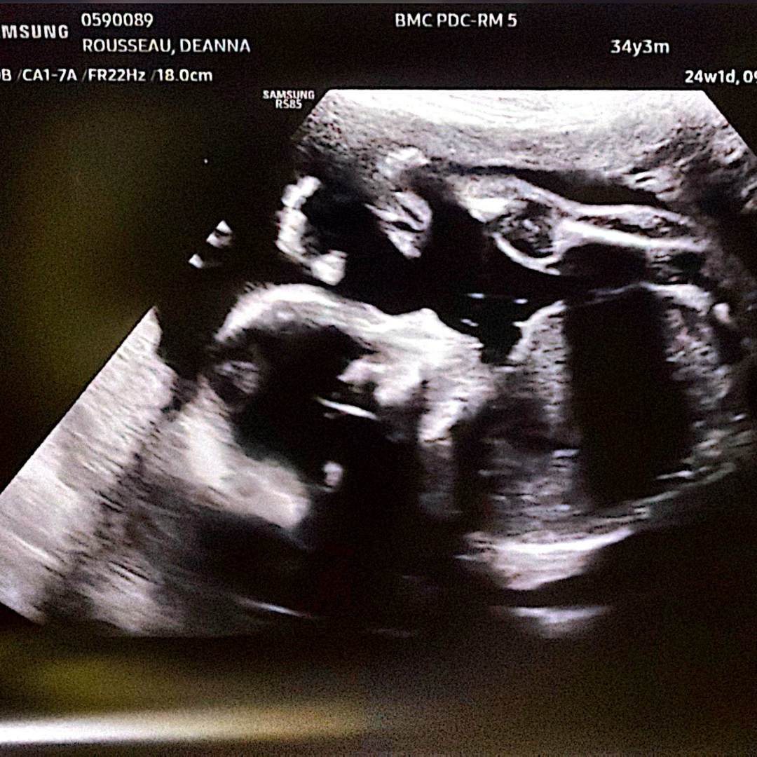 Photo shared by Deanna for their Babylist baby registry.