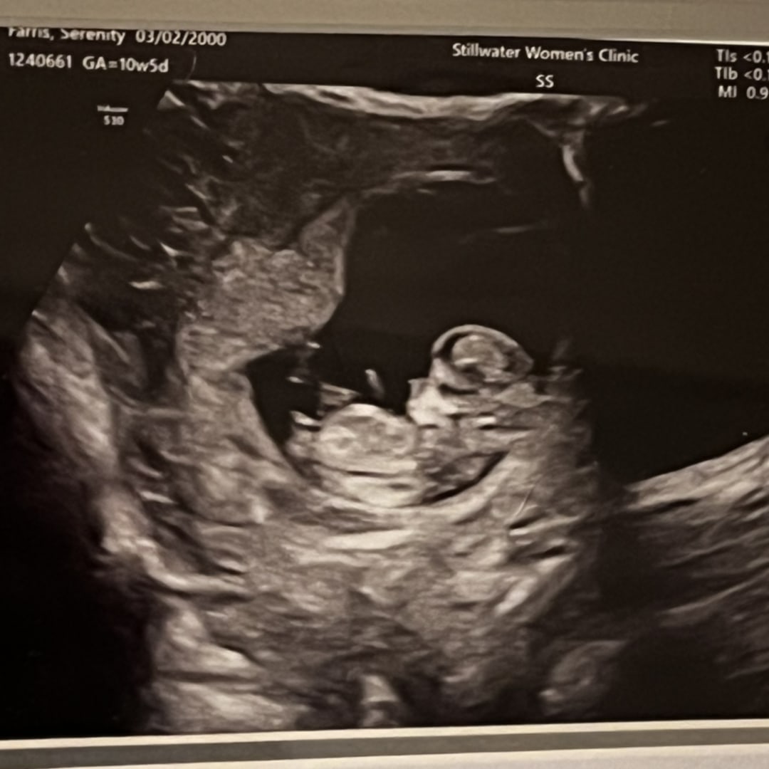 Photo shared by Serenity for their Babylist baby registry.