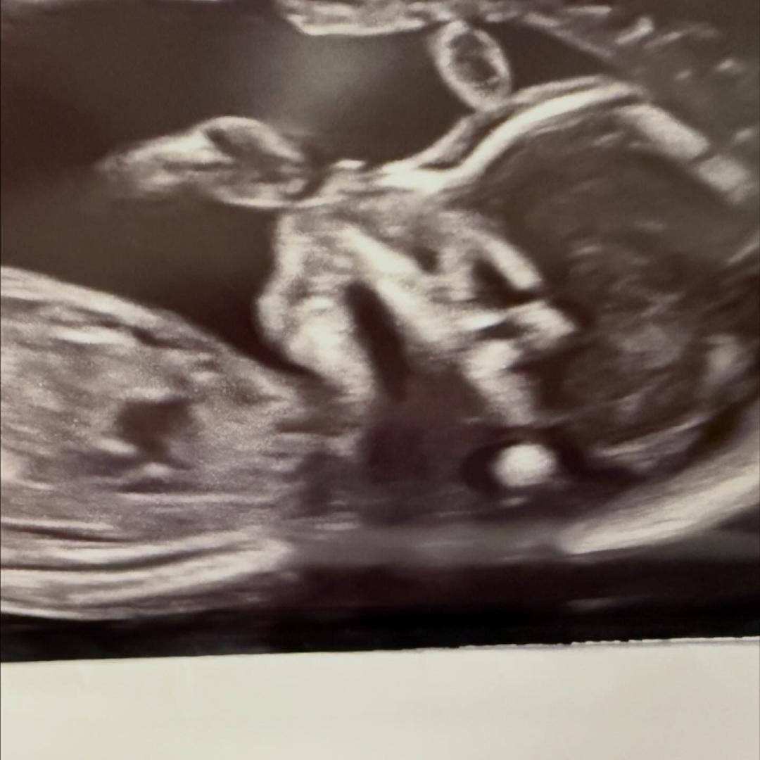 Photo shared by Faith for their Babylist baby registry.