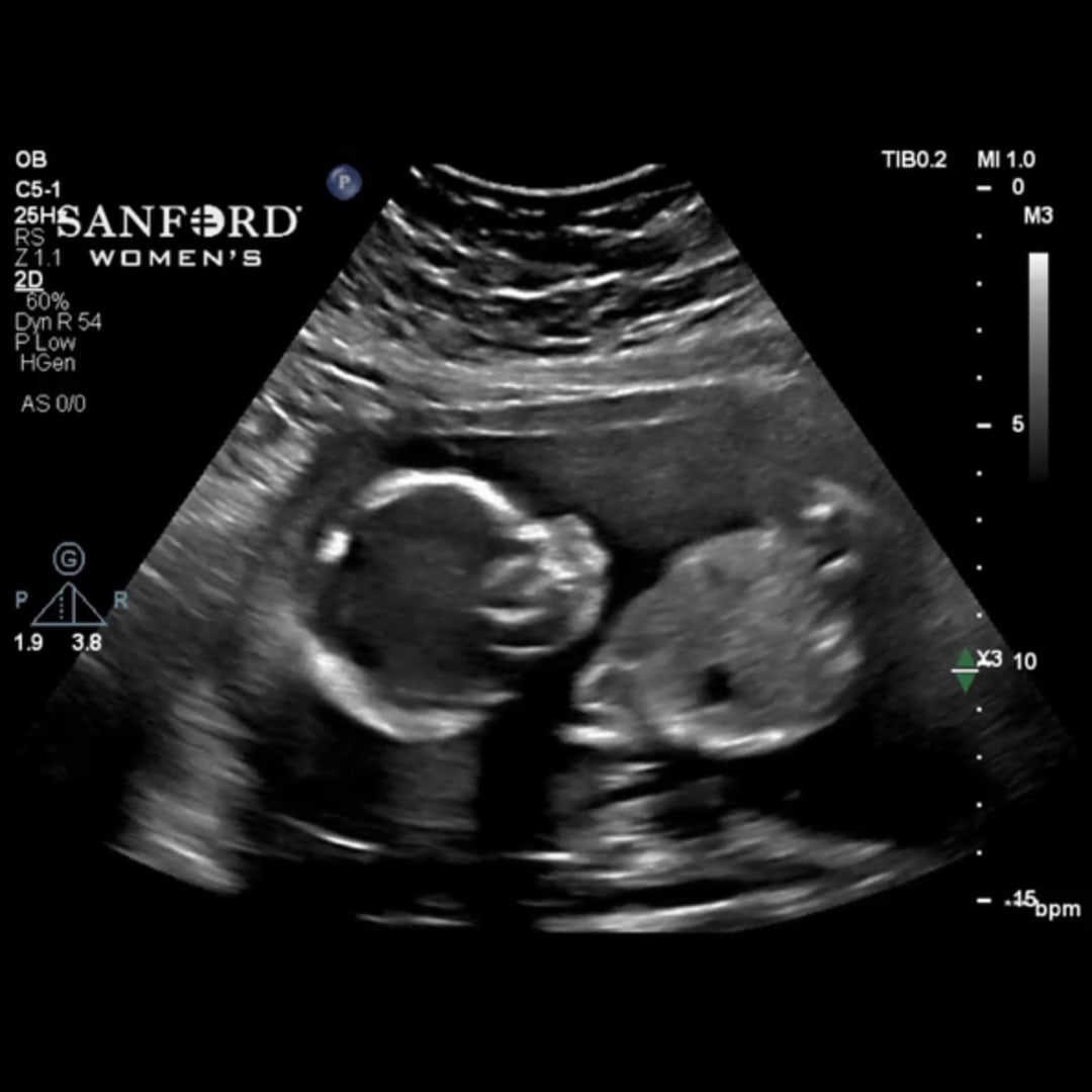 Photo shared by Cora for their Babylist baby registry.