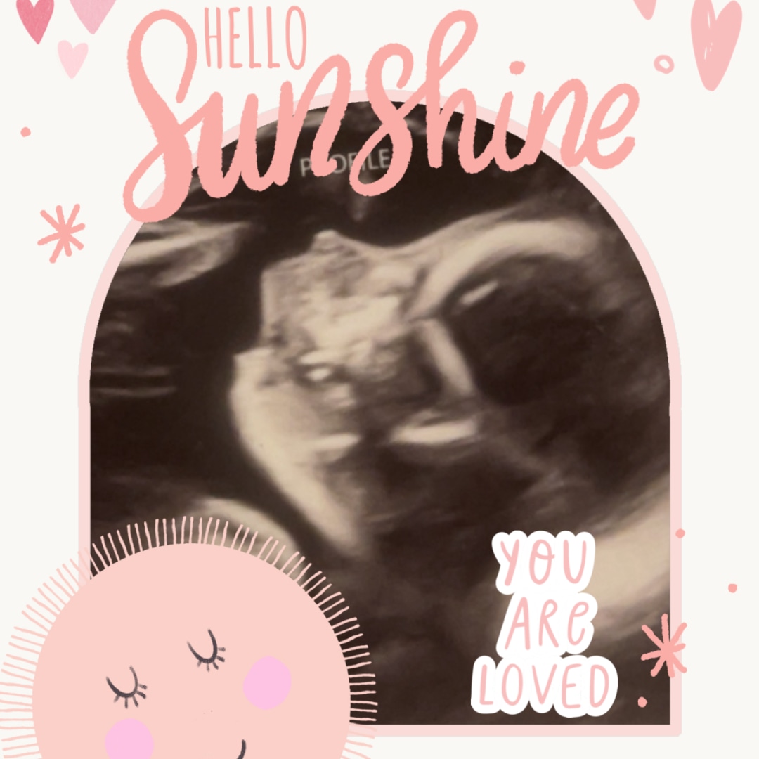 Photo shared by Ivy for their Babylist baby registry.