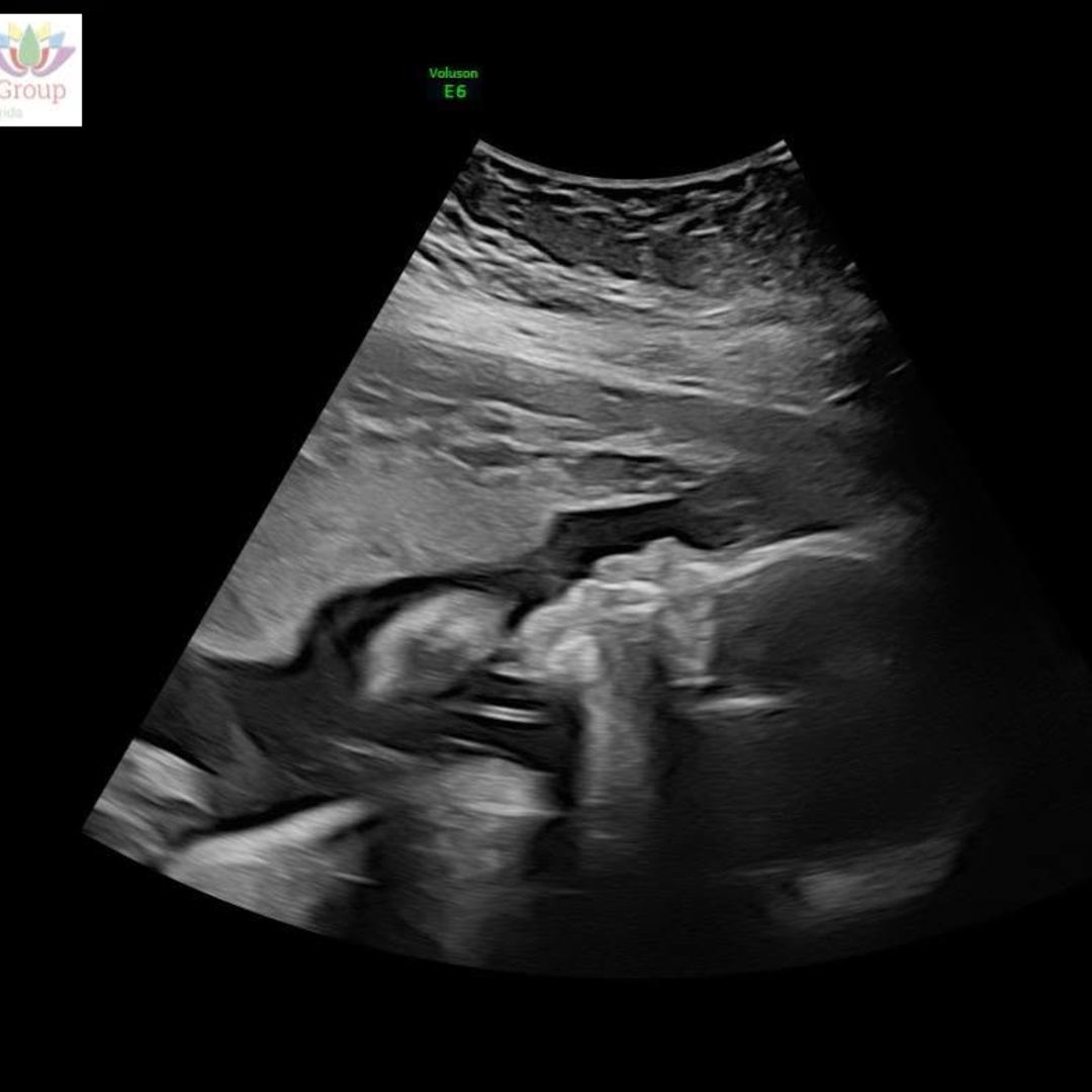 Photo shared by Patti for their Babylist baby registry.
