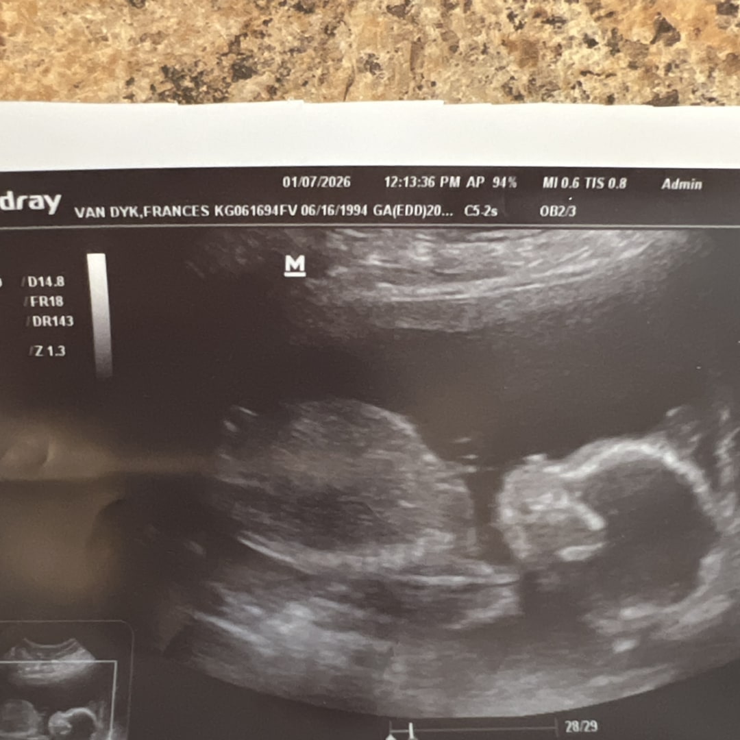 Photo shared by Frances for their Babylist baby registry.