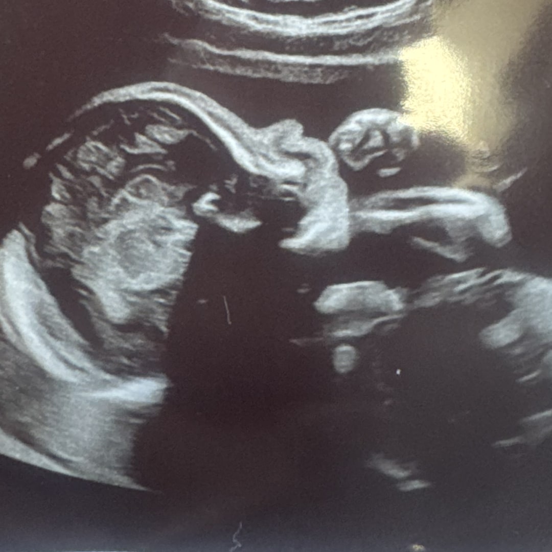 Photo shared by Mya for their Babylist baby registry.