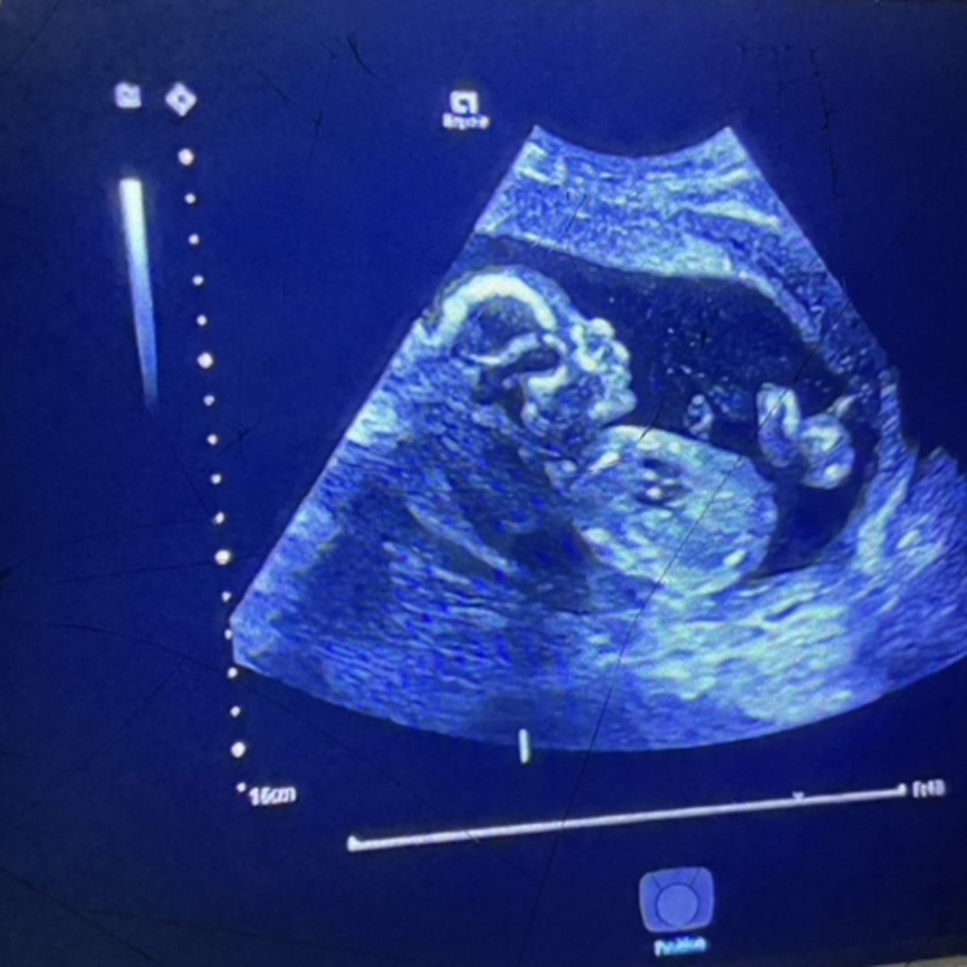 Photo shared by Katie for their Babylist baby registry.