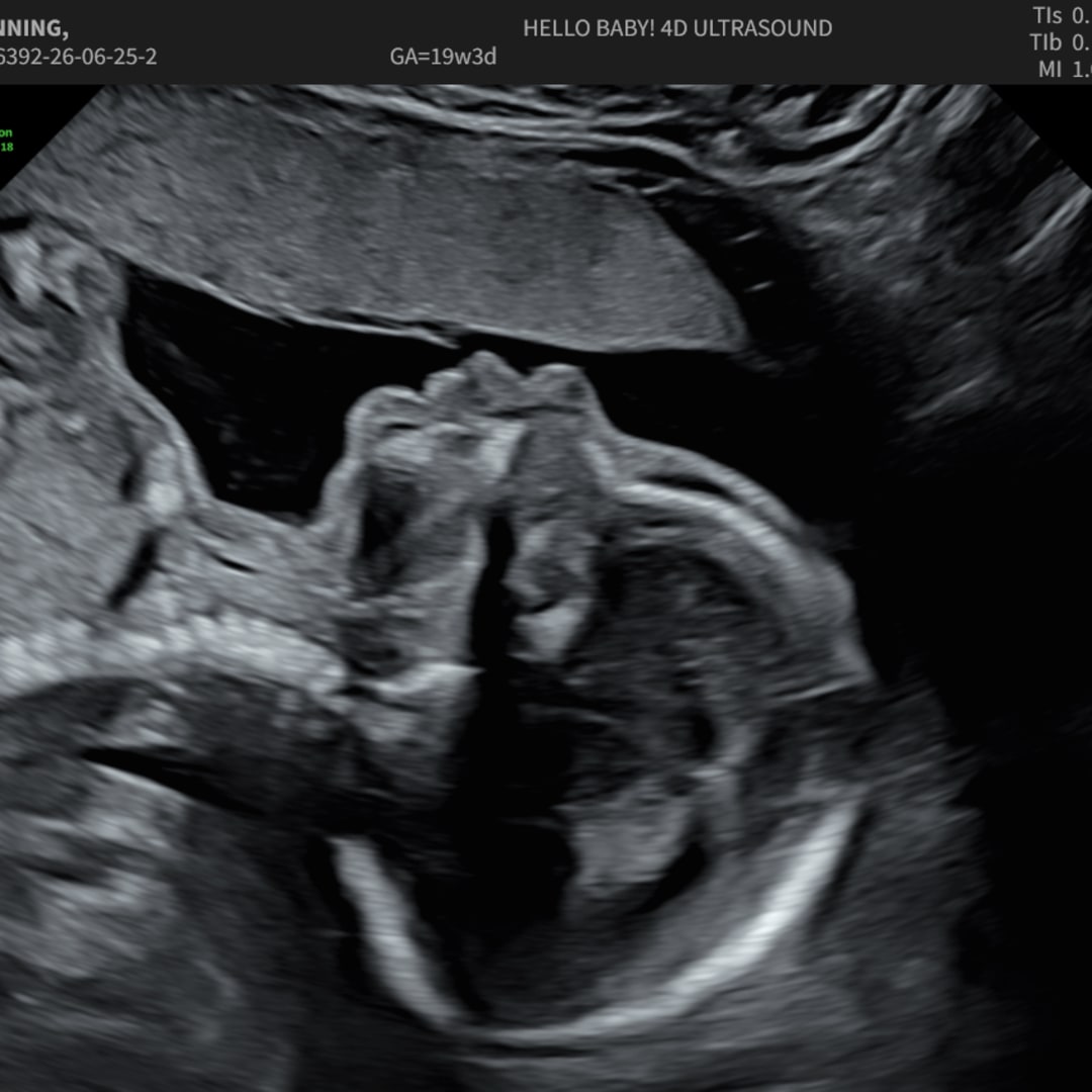 Photo shared by Alexis for their Babylist baby registry.