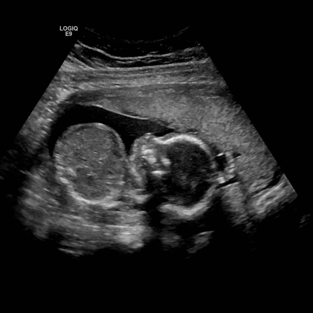 Photo shared by Bailey for their Babylist baby registry.