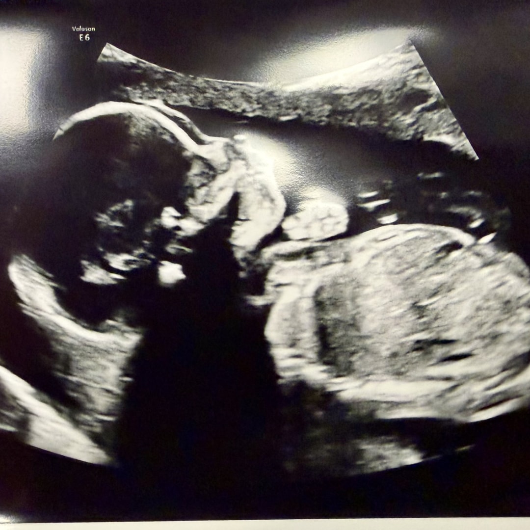 Photo shared by Carly for their Babylist baby registry.