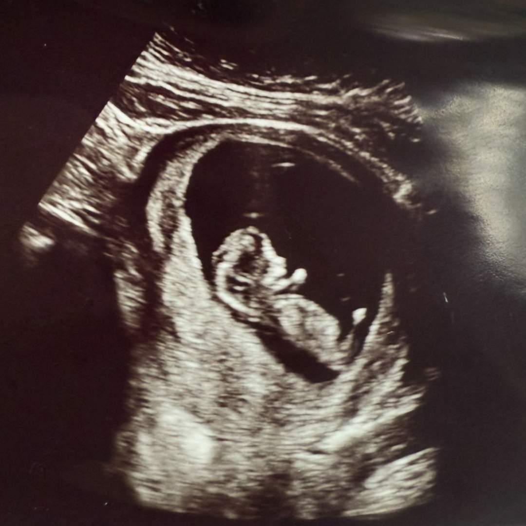 Photo shared by Desirea for their Babylist baby registry.