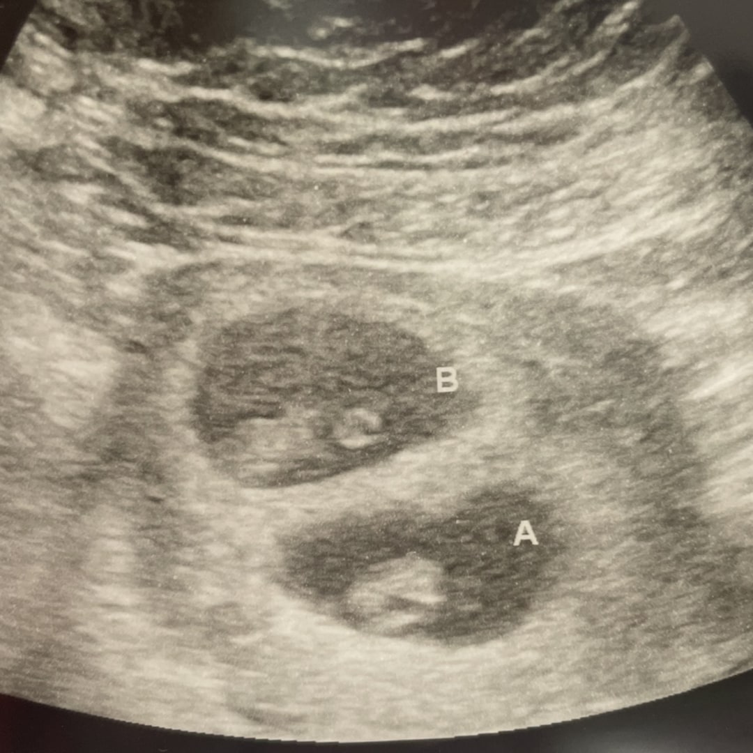 Photo shared by Martha for their Babylist baby registry.