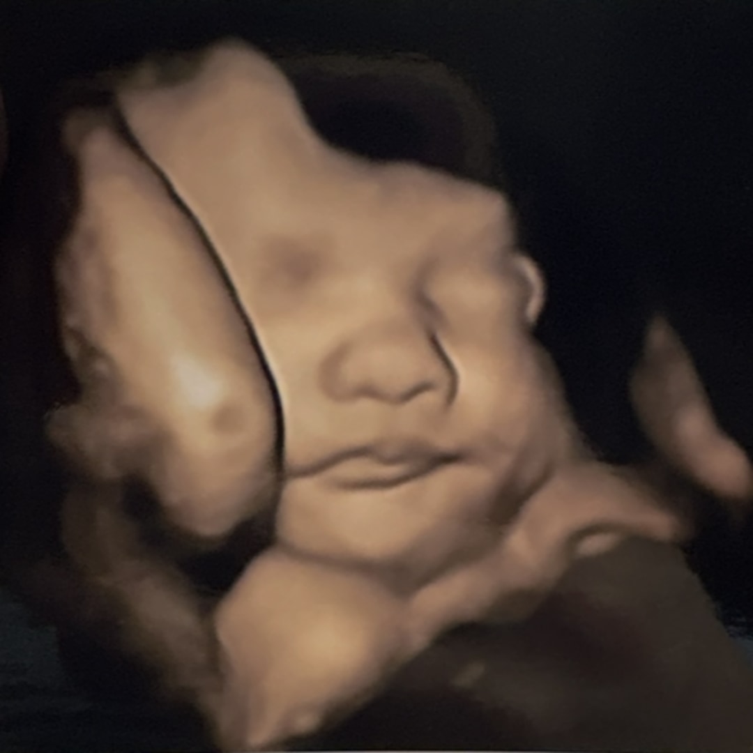 Photo shared by Madison for their Babylist baby registry.