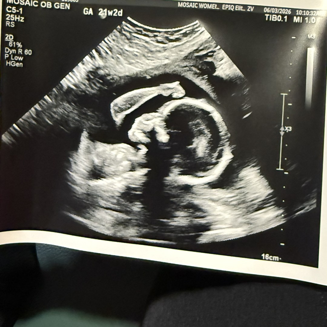 Photo shared by Alexis for their Babylist baby registry.