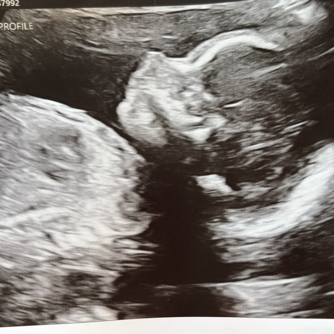 Photo shared by Christina for their Babylist baby registry.