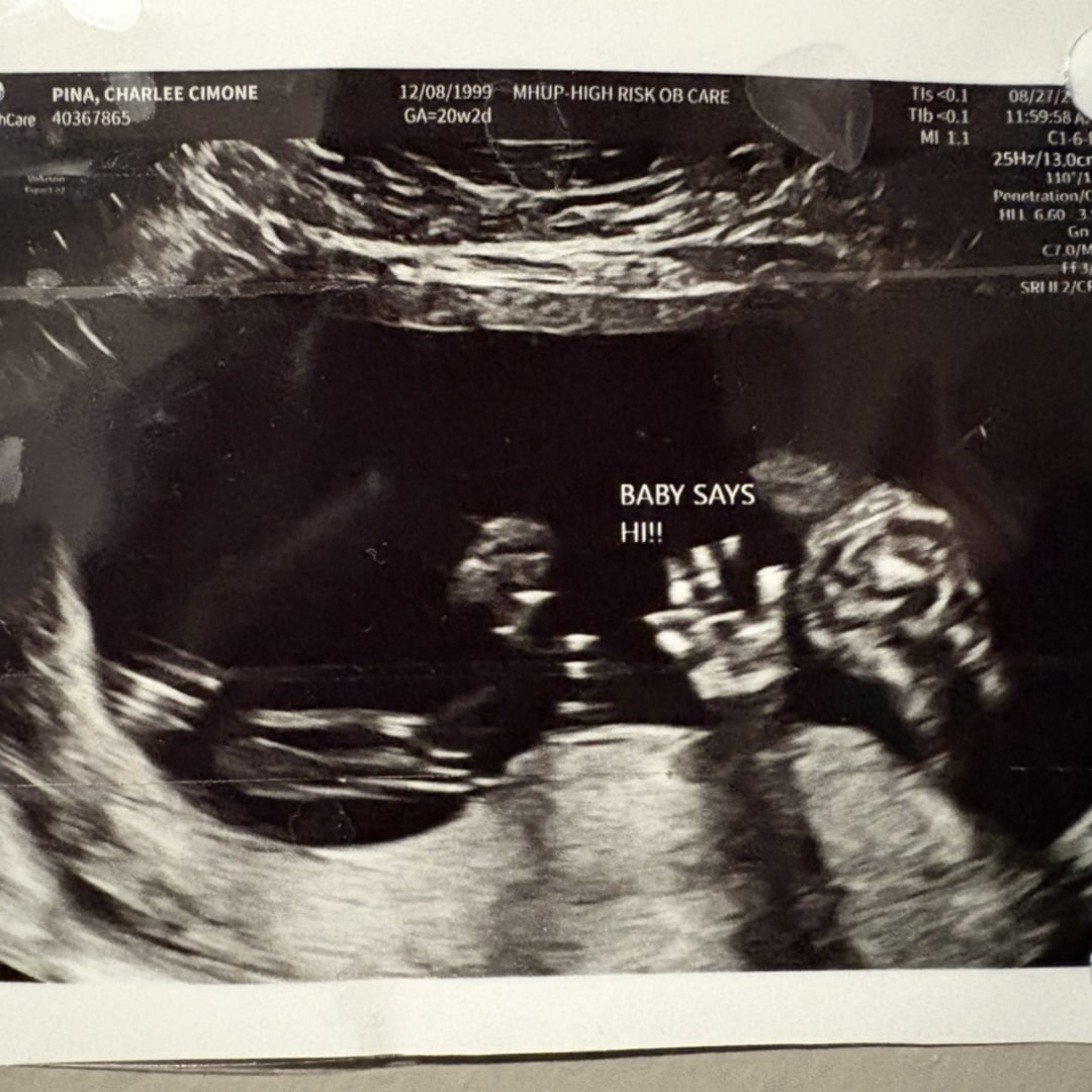 Photo shared by Charlee for their Babylist baby registry.