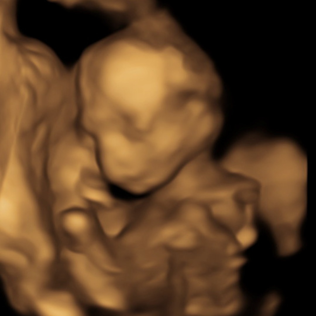 Photo shared by Sreynuch for their Babylist baby registry.