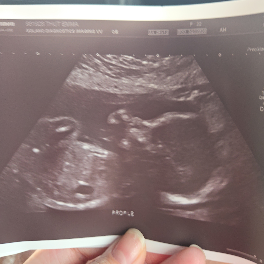 Photo shared by Emma for their Babylist baby registry.