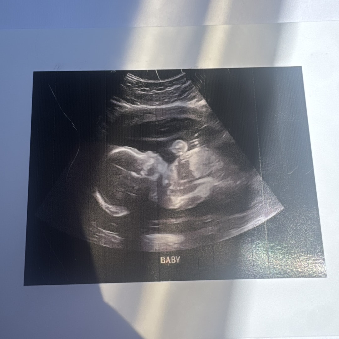 Photo shared by Kate Veniz for their Babylist baby registry.