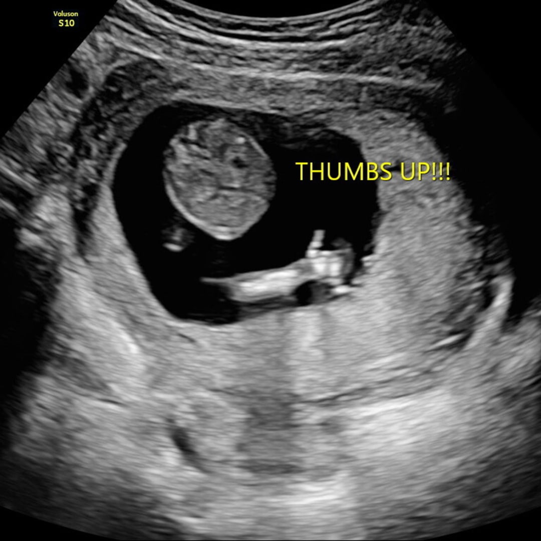 Photo shared by Miranda for their Babylist baby registry.