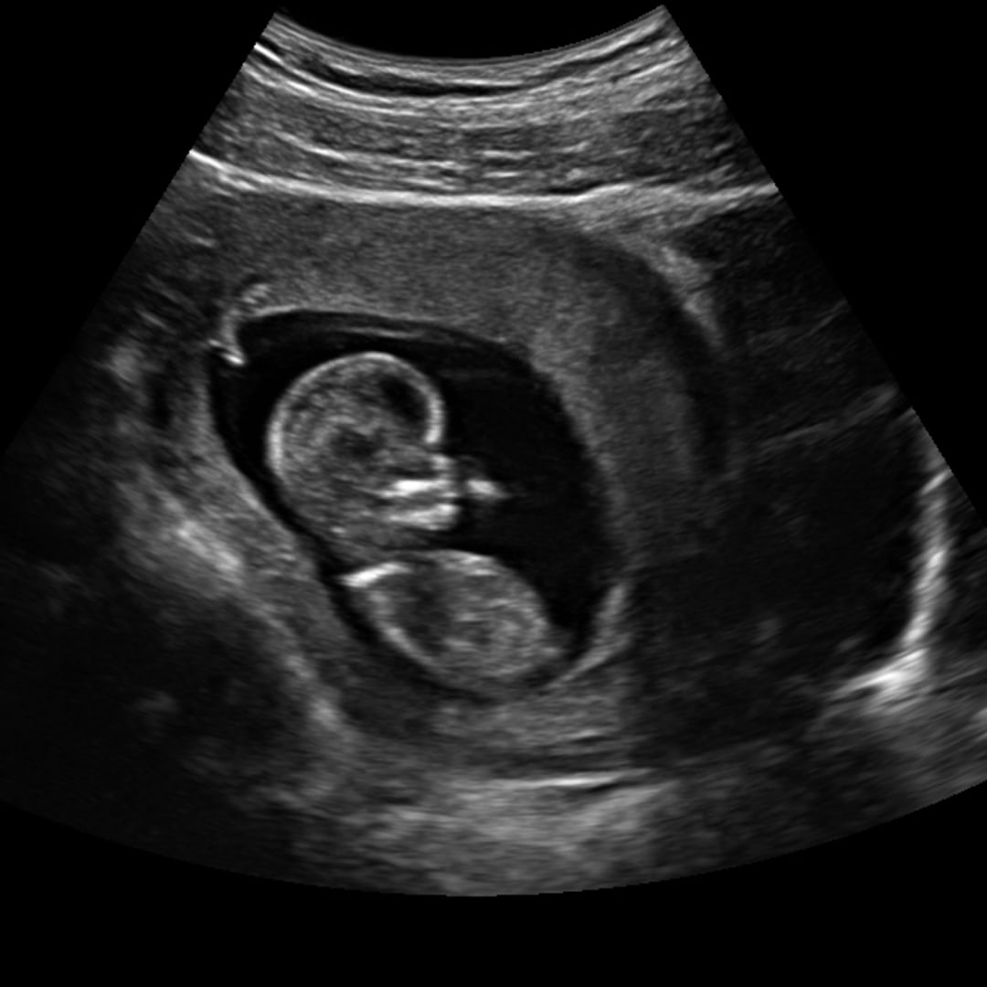 Photo shared by Annemarie for their Babylist baby registry.