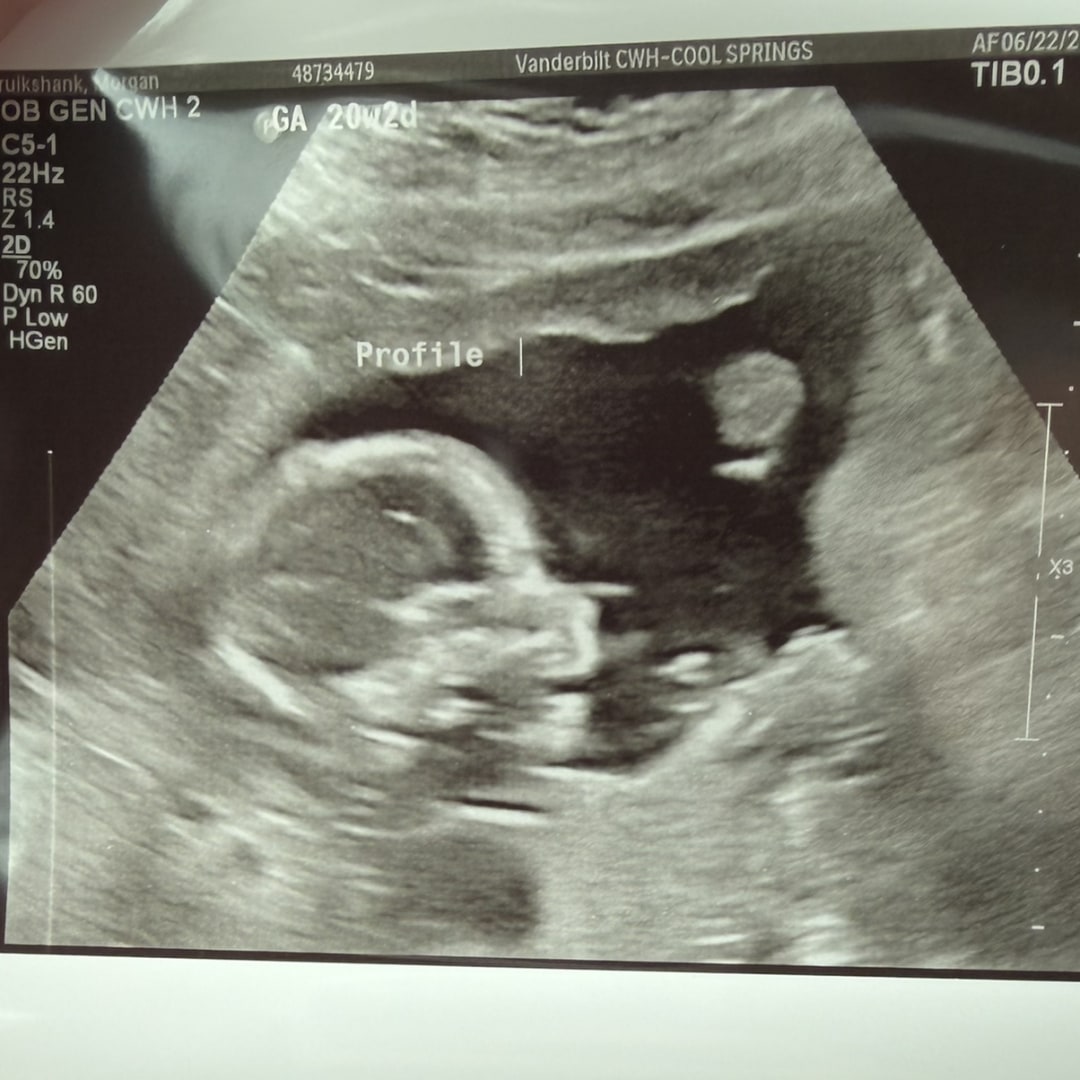 Photo shared by Morgan for their Babylist baby registry.