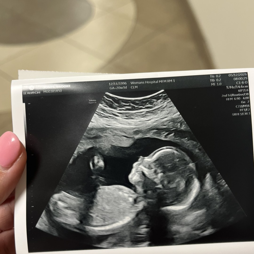 Photo shared by Brooke for their Babylist baby registry.