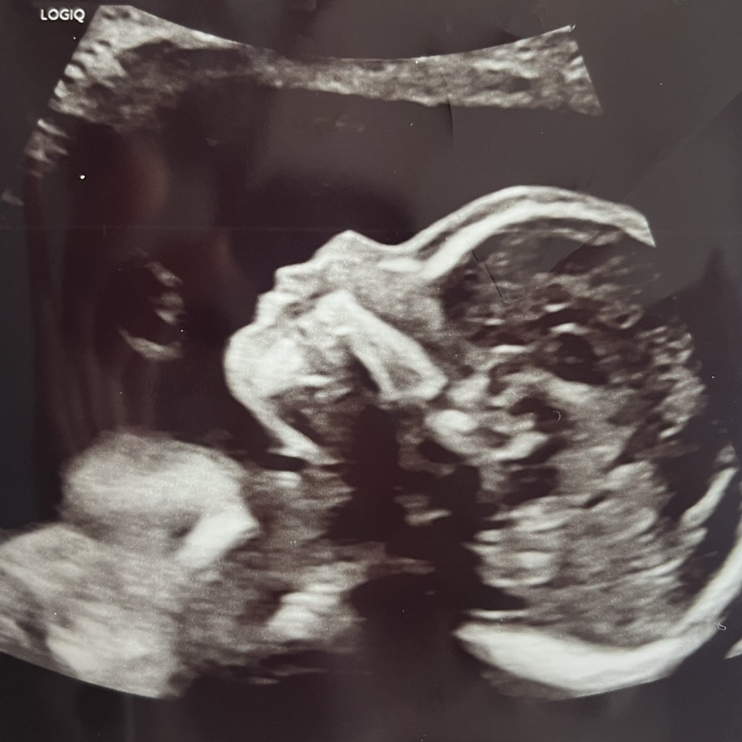 Photo shared by Mercedez for their Babylist baby registry.