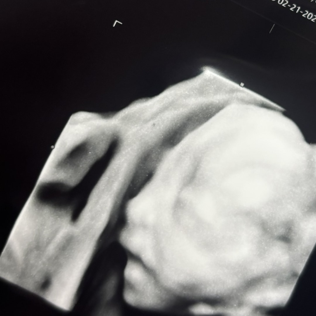 Photo shared by Karissa for their Babylist baby registry.