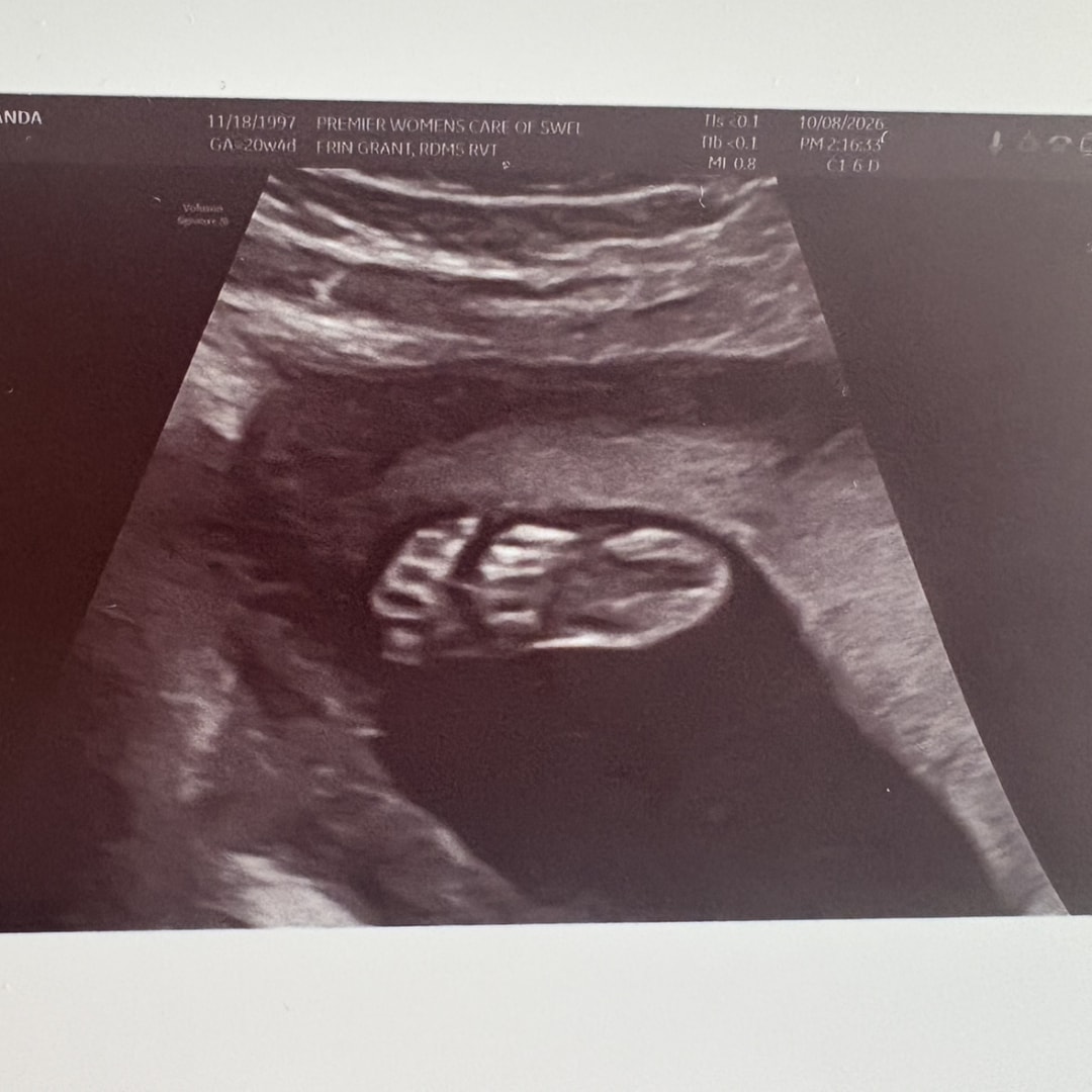 Photo shared by Amanda for their Babylist baby registry.