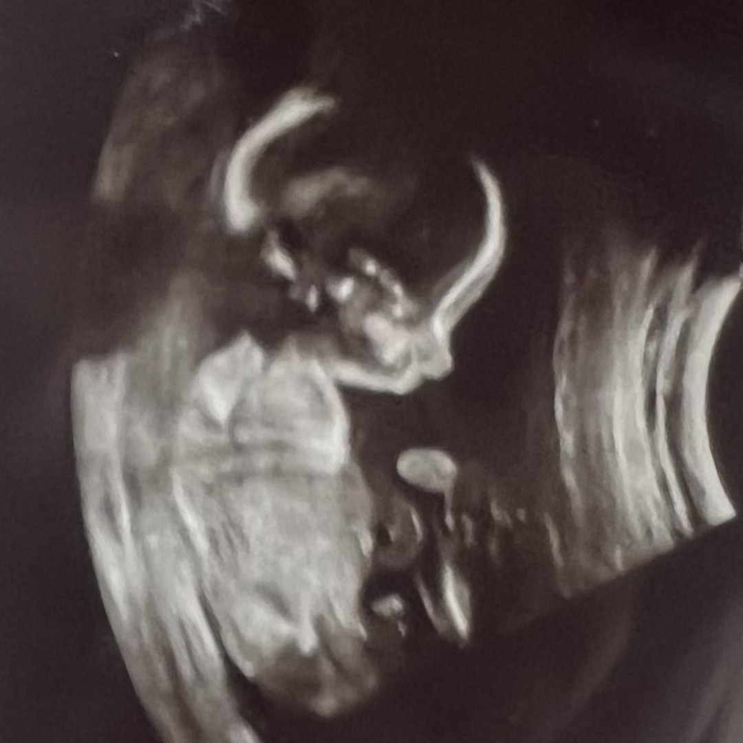 Photo shared by Rissa for their Babylist baby registry.