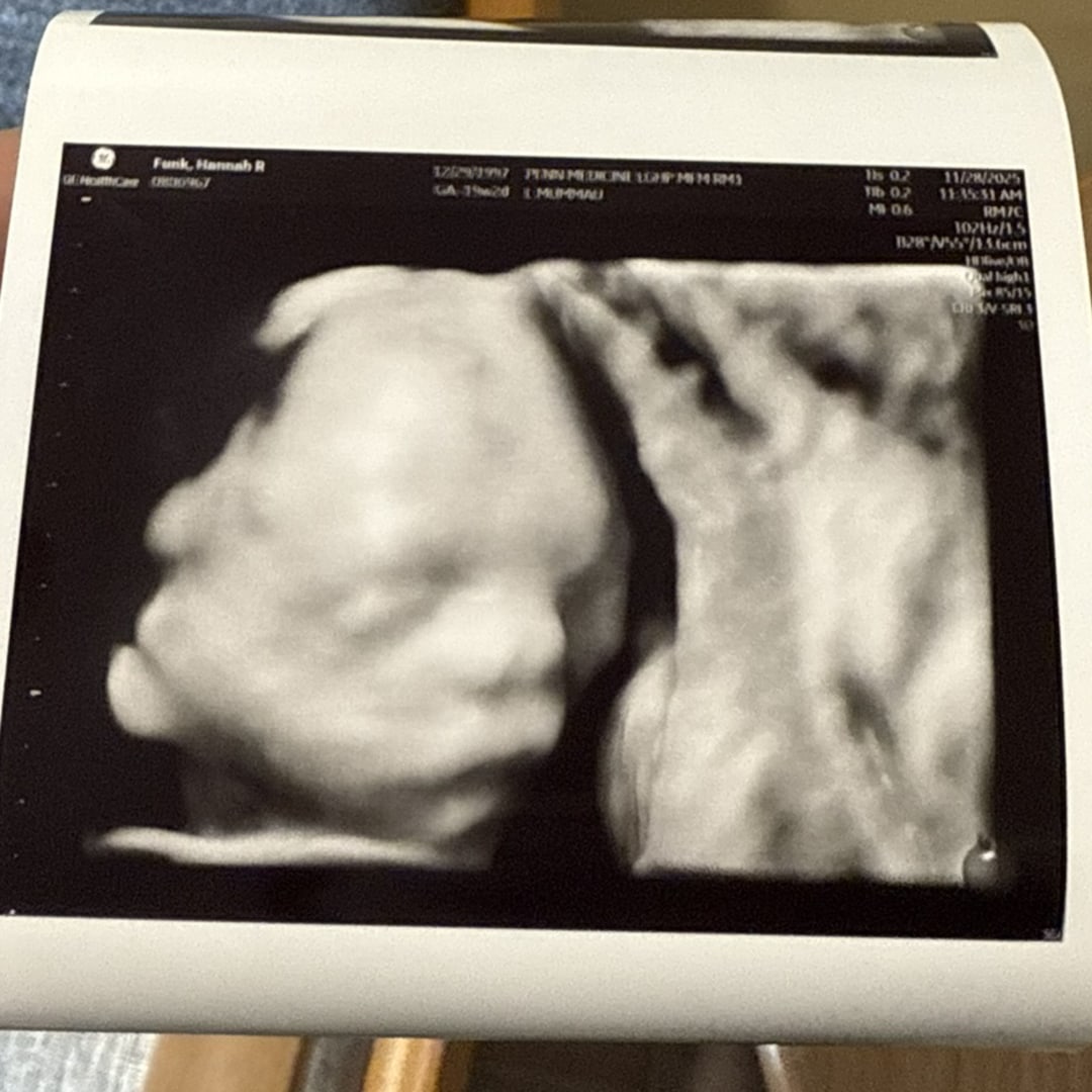 Photo shared by Hannah for their Babylist baby registry.