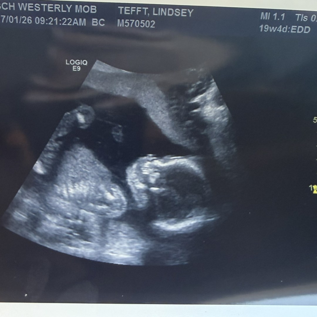 Photo shared by Lindsey for their Babylist baby registry.