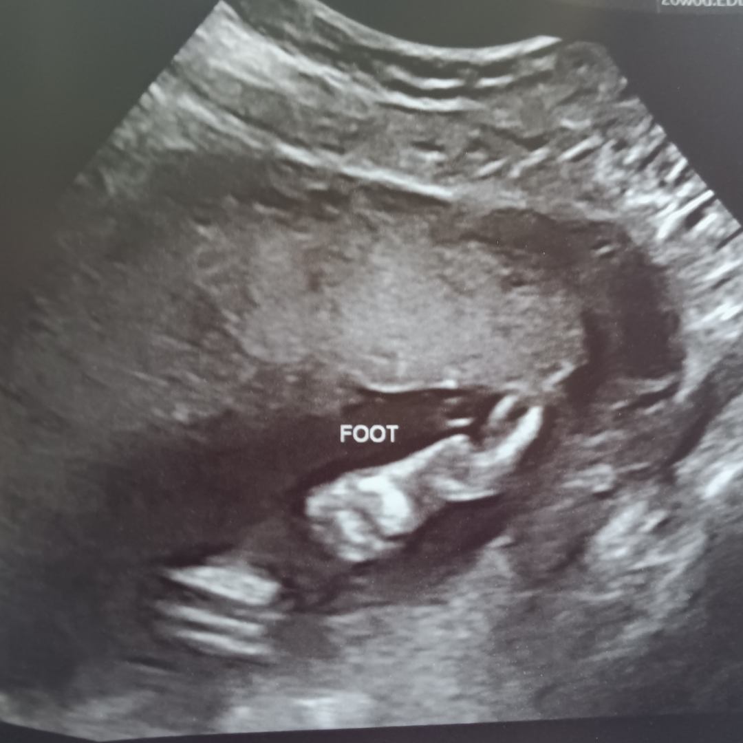 Photo shared by Mya for their Babylist baby registry.
