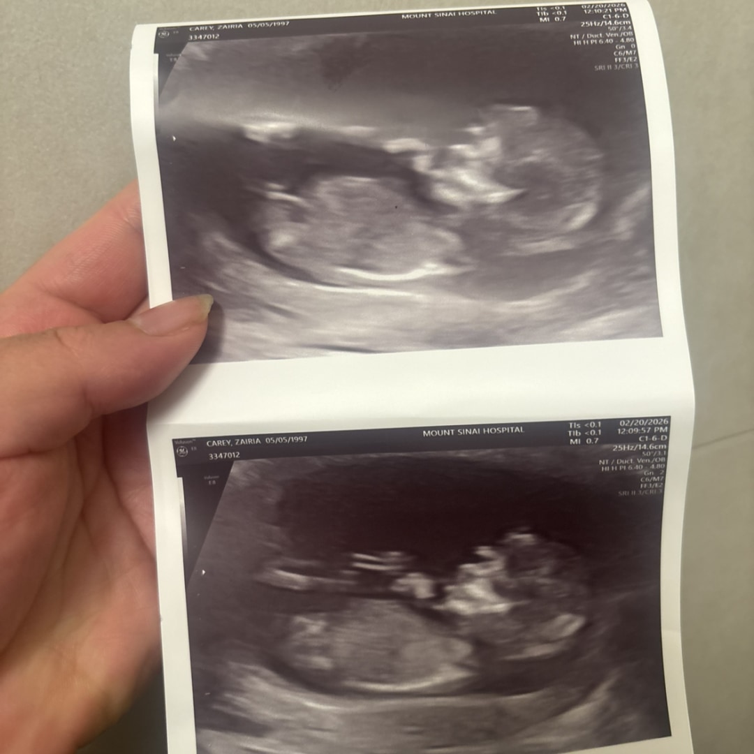 Photo shared by Zairia for their Babylist baby registry.