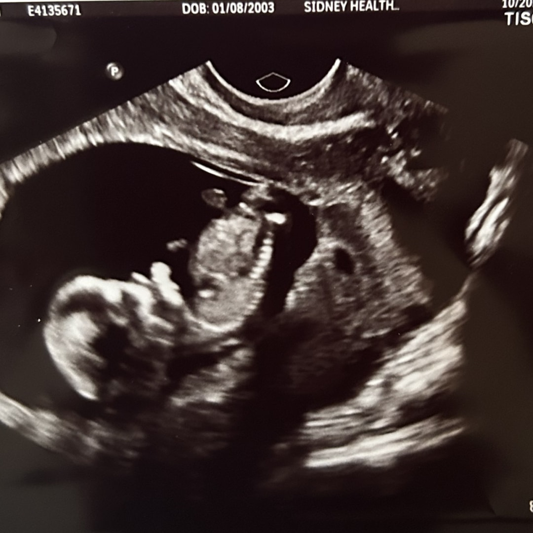 Photo shared by Jade for their Babylist baby registry.