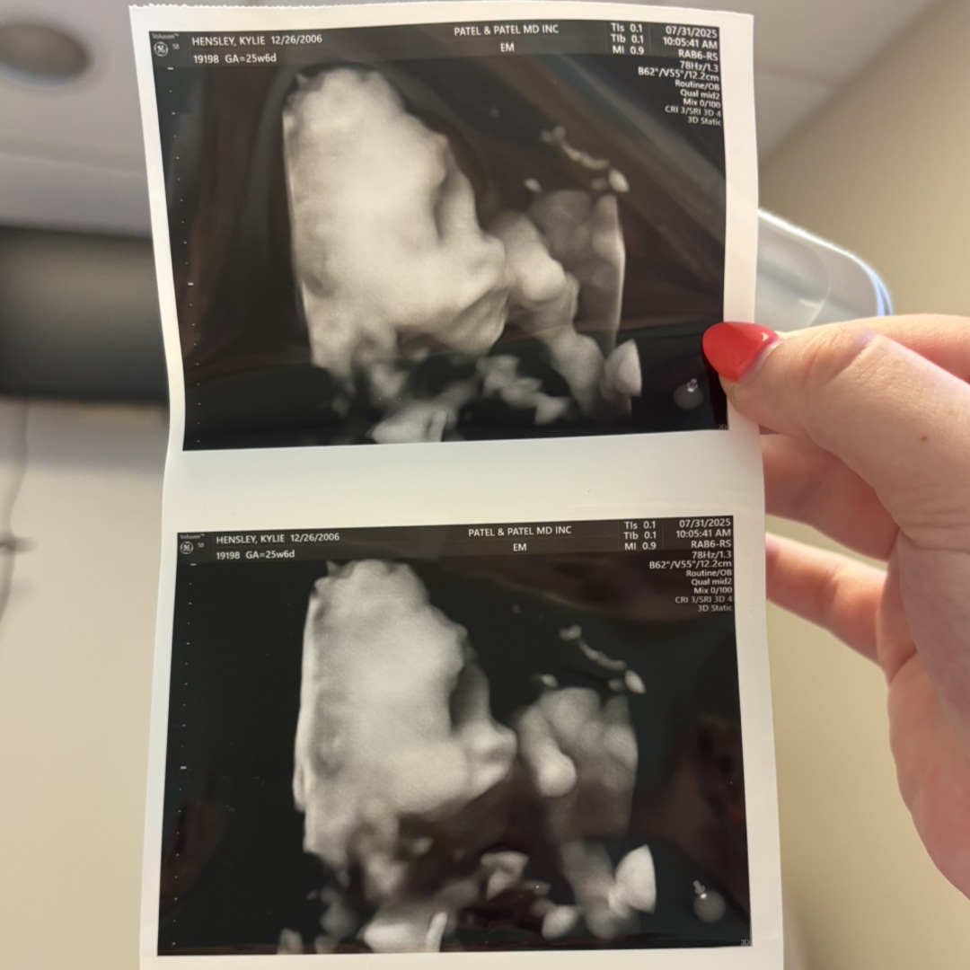 Photo shared by Kylie for their Babylist baby registry.
