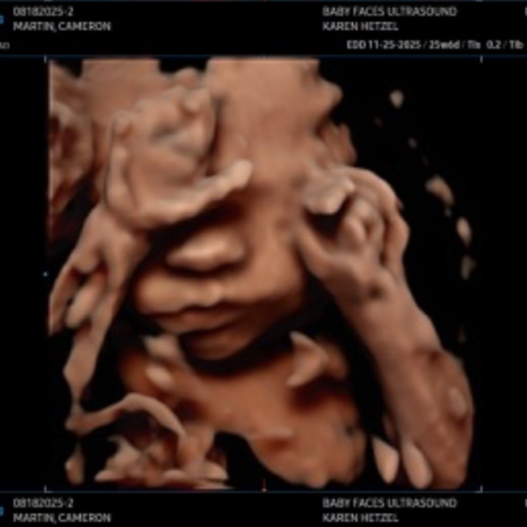 Photo shared by Cameron for their Babylist baby registry.