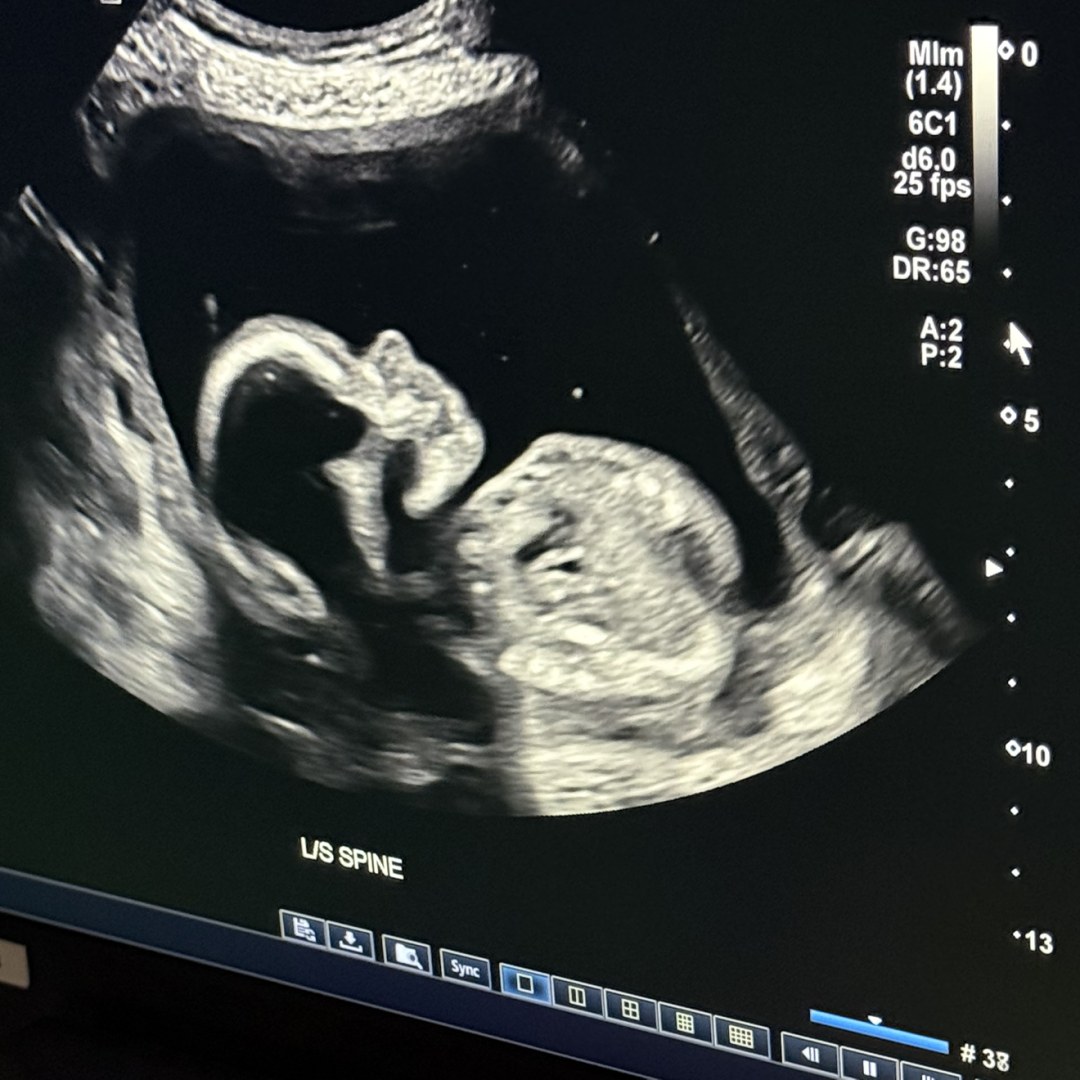 Photo shared by Heather for their Babylist baby registry.