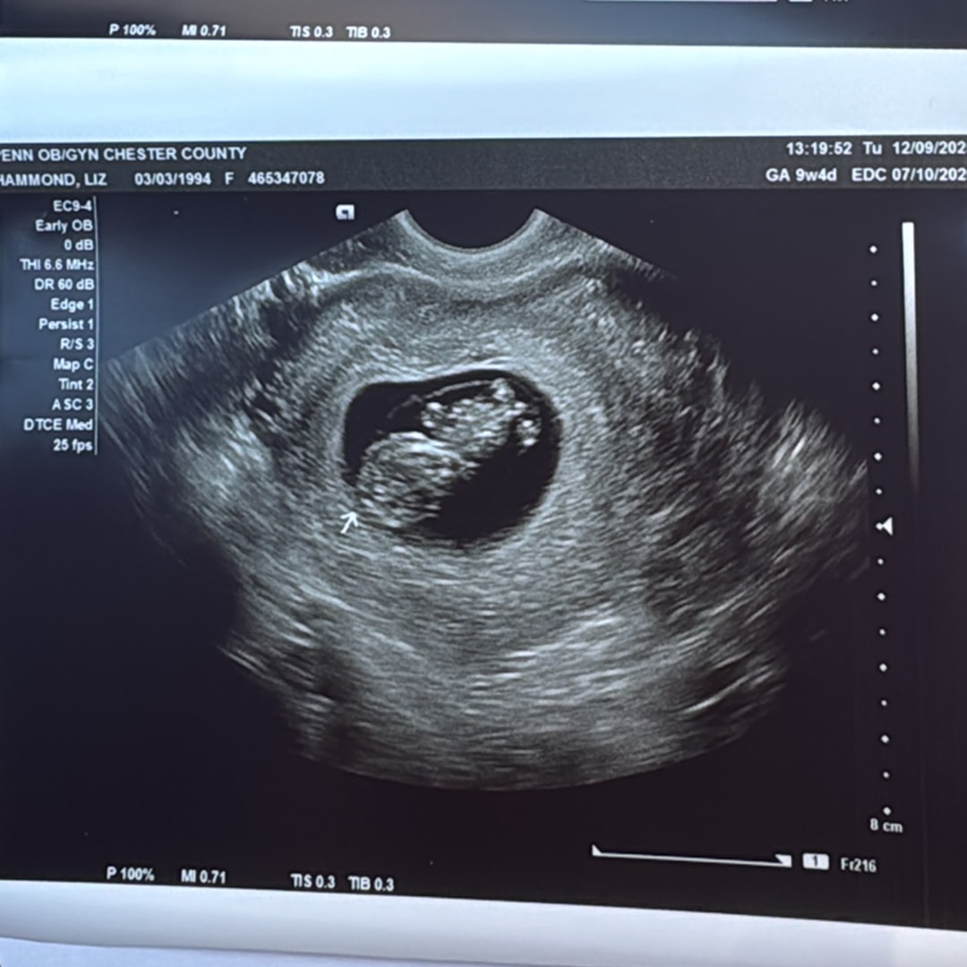 Photo shared by Liz for their Babylist baby registry.
