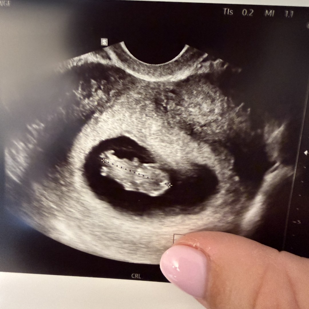 Photo shared by Mary Beth for their Babylist baby registry.