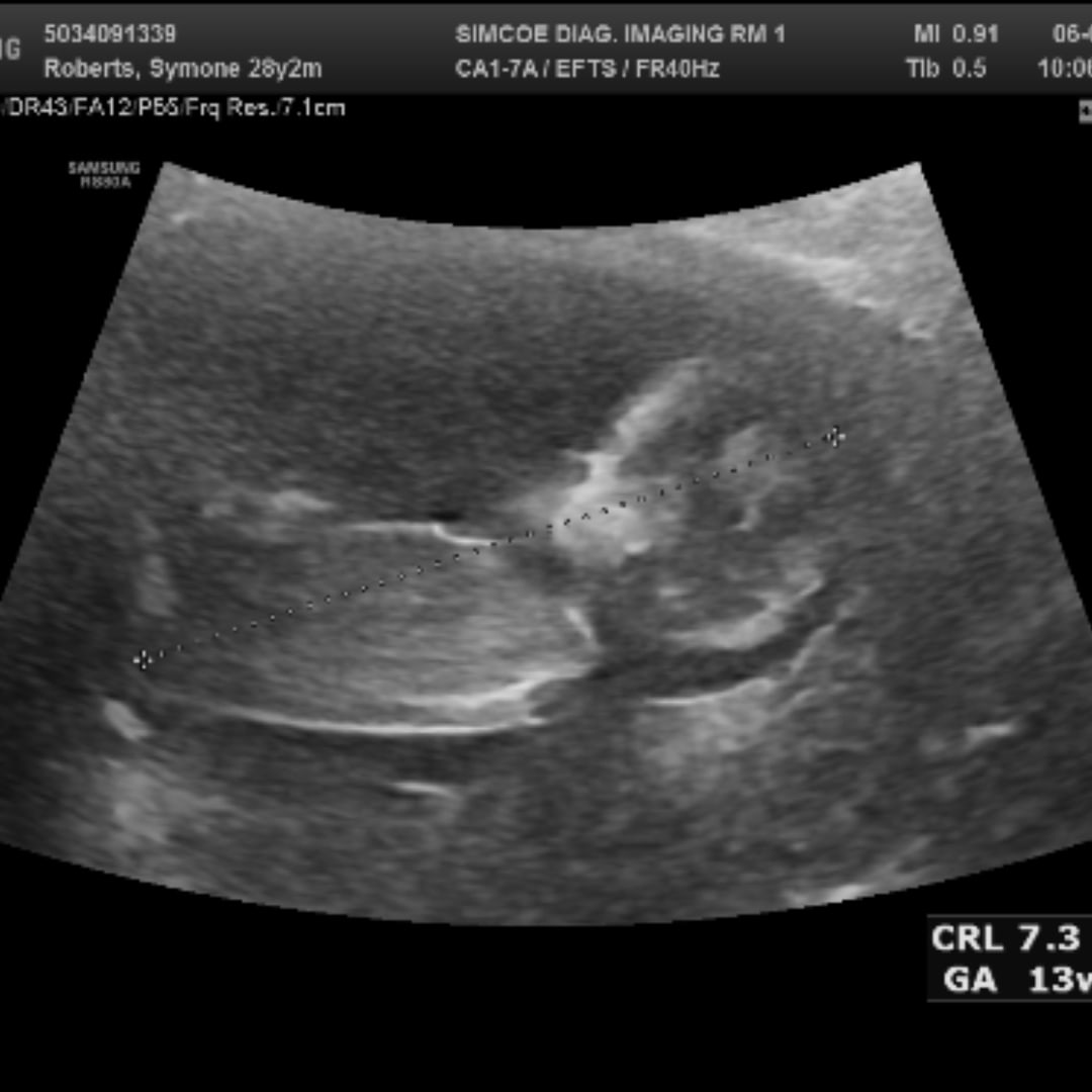 Photo shared by Symone for their Babylist baby registry.