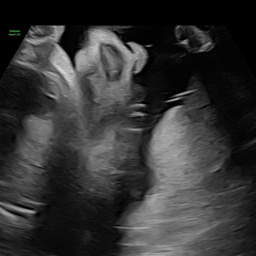 Photo shared by Ashlynne for their Babylist baby registry.