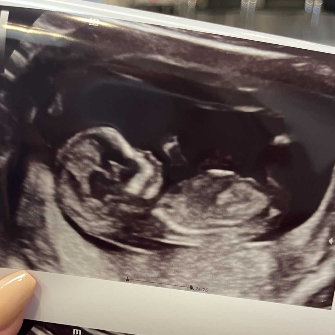 Photo shared by Ava Marie for their Babylist baby registry.