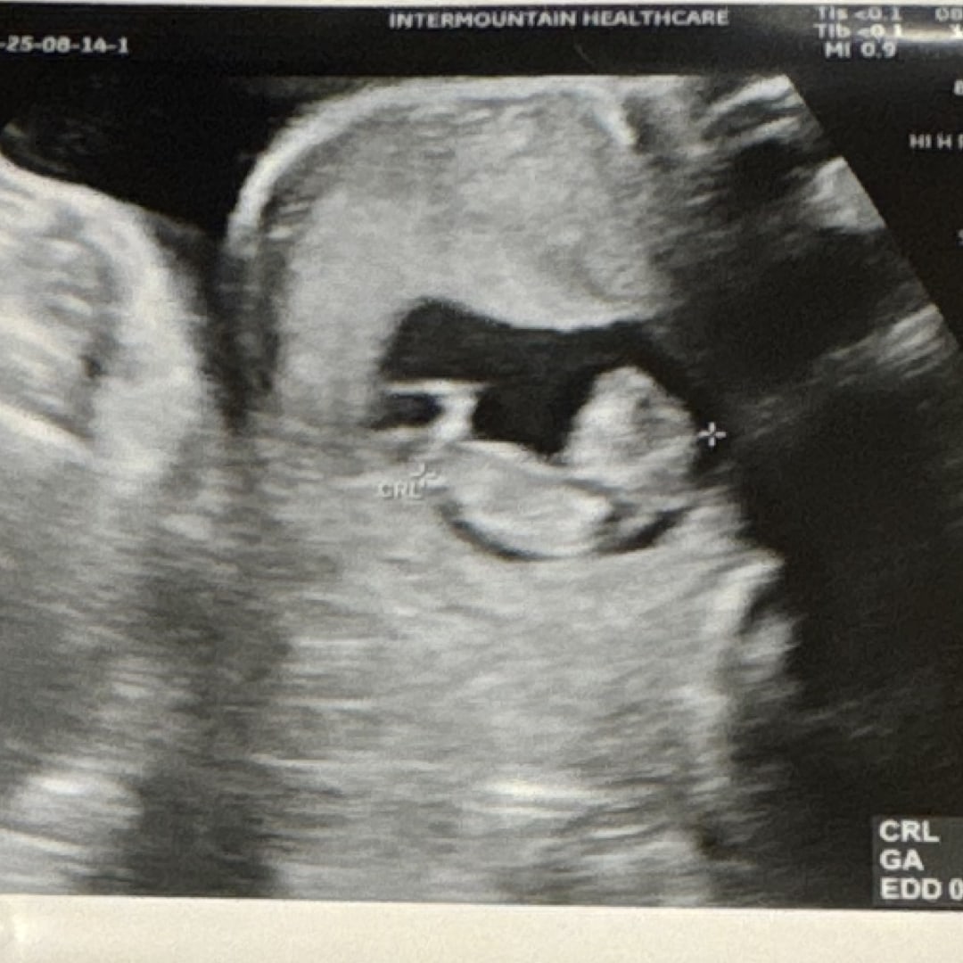 Photo shared by Elize for their Babylist baby registry.