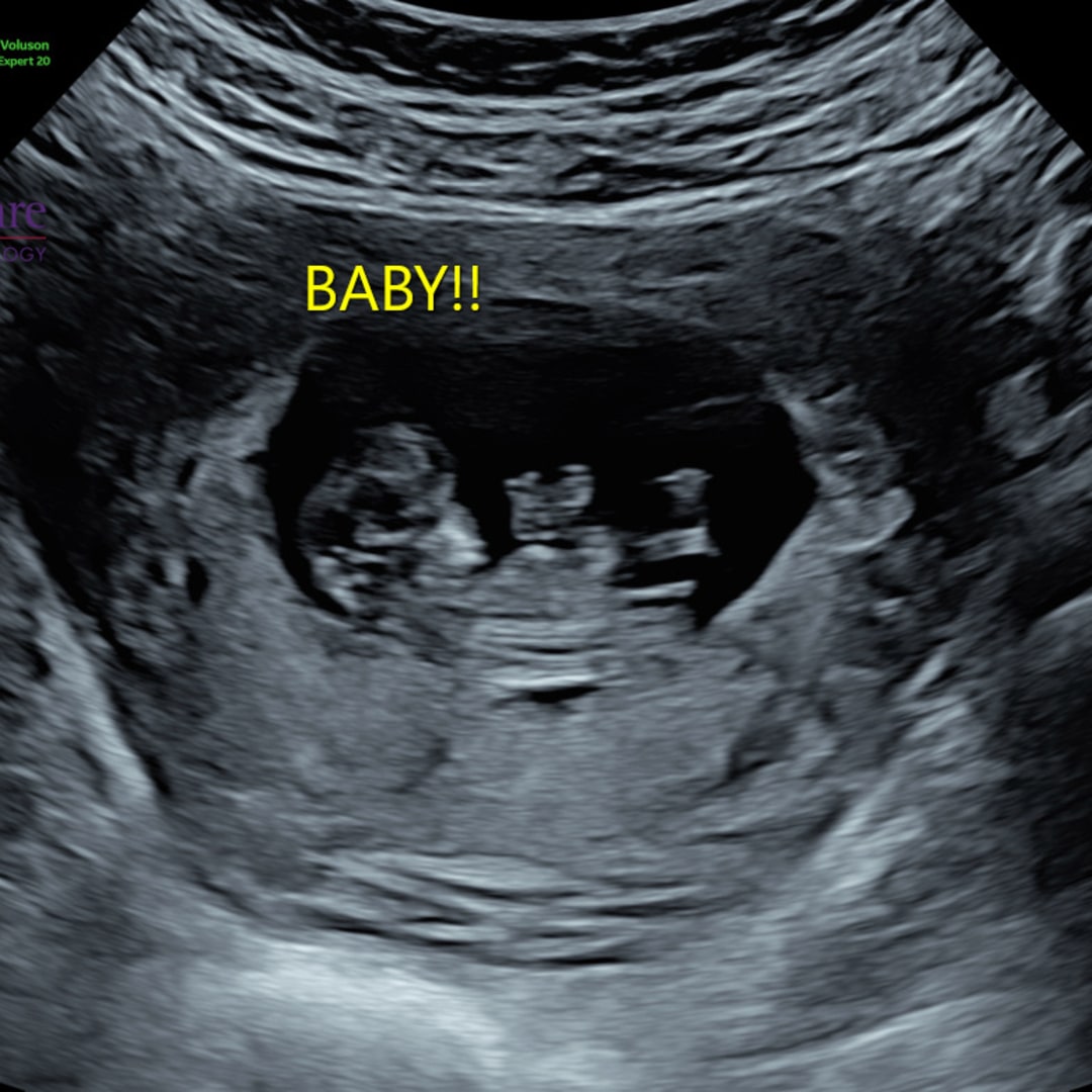 Photo shared by Emily for their Babylist baby registry.