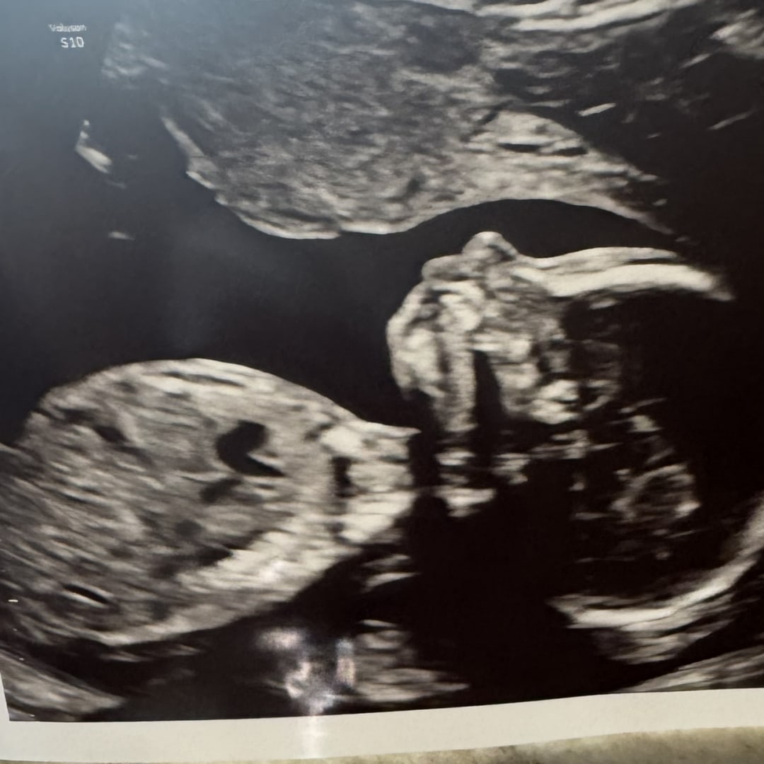 Photo shared by Bianca for their Babylist baby registry.