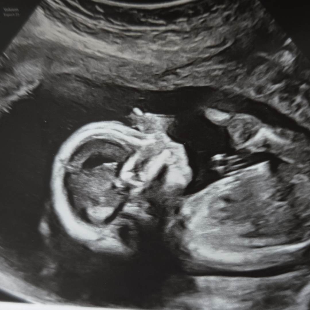 Photo shared by Adrienne for their Babylist baby registry.