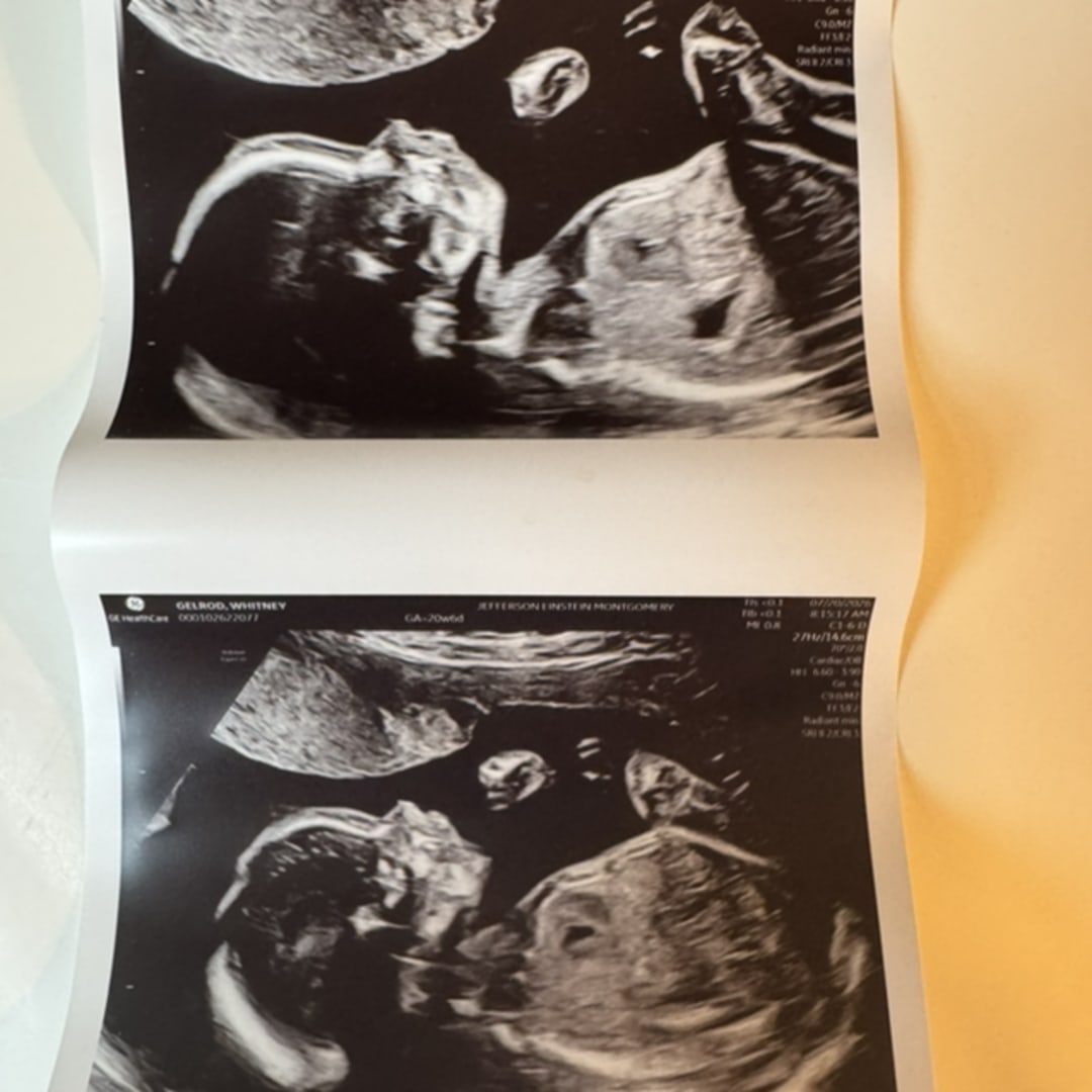 Photo shared by Whitney for their Babylist baby registry.