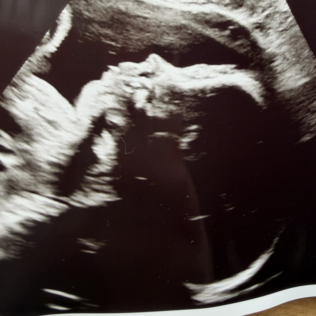 Photo shared by Miranda for their Babylist baby registry.