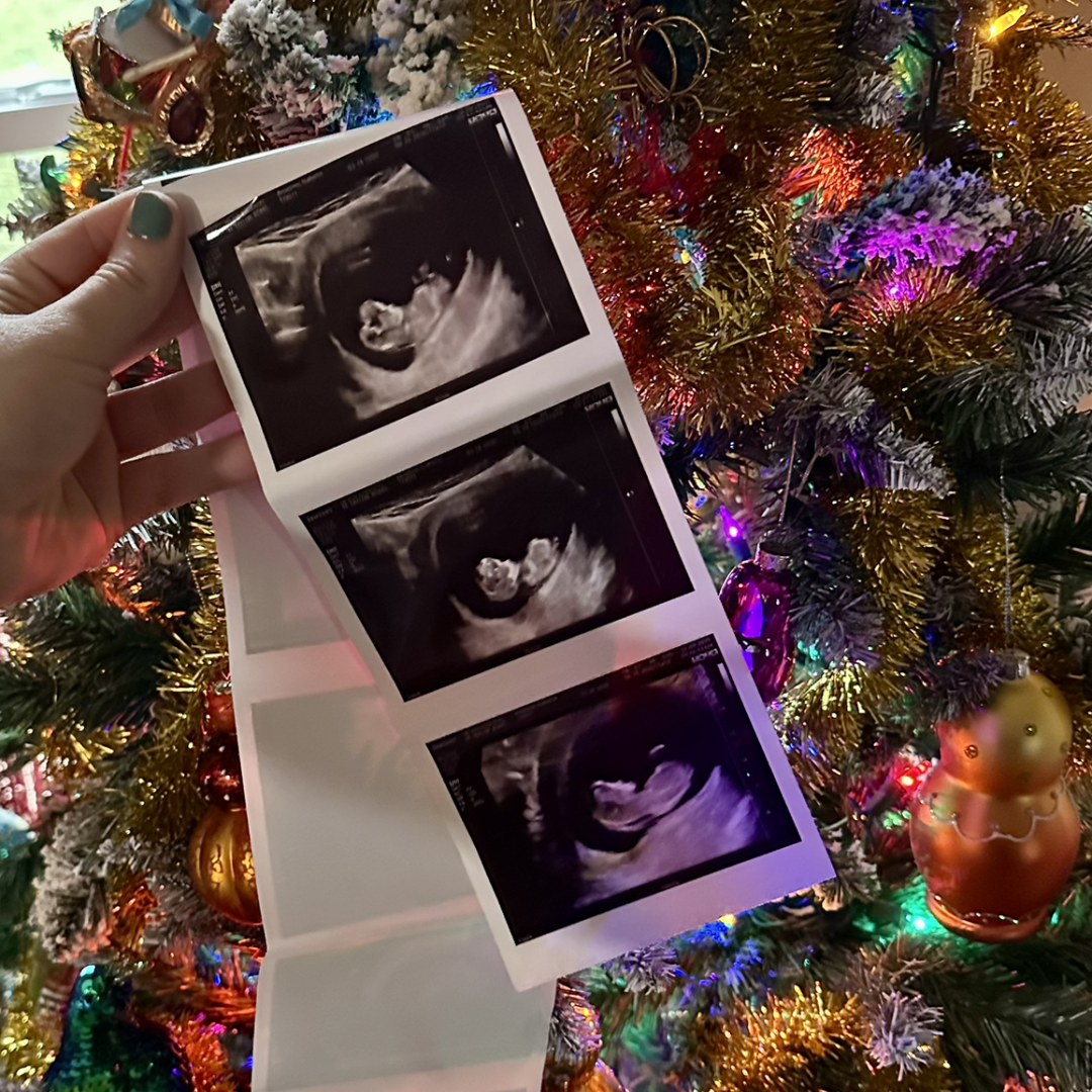 Photo shared by Frankie for their Babylist baby registry.