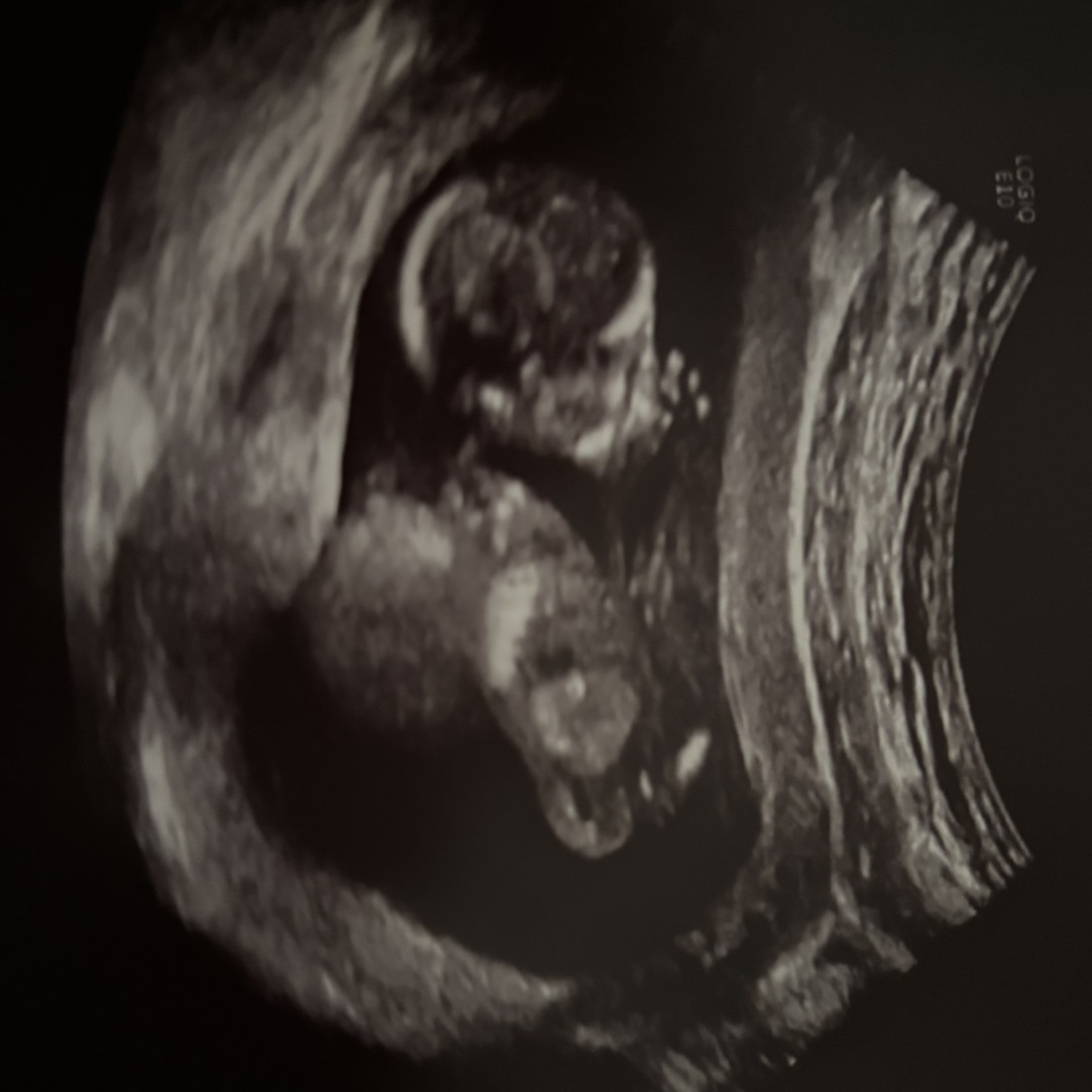 Photo shared by Cecilia for their Babylist baby registry.